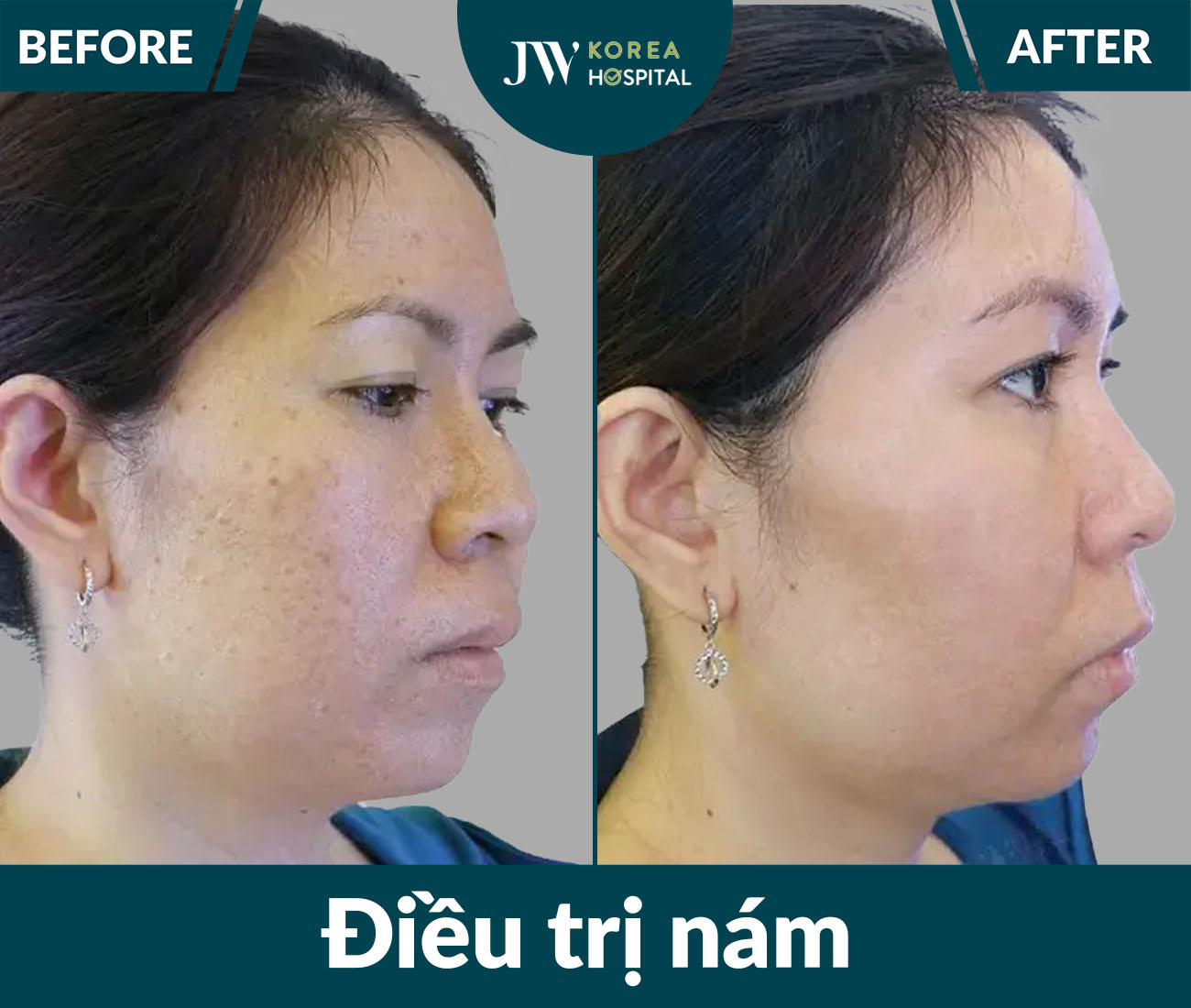 Điều trị da