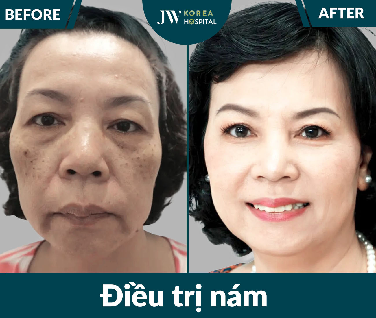 Điều trị da