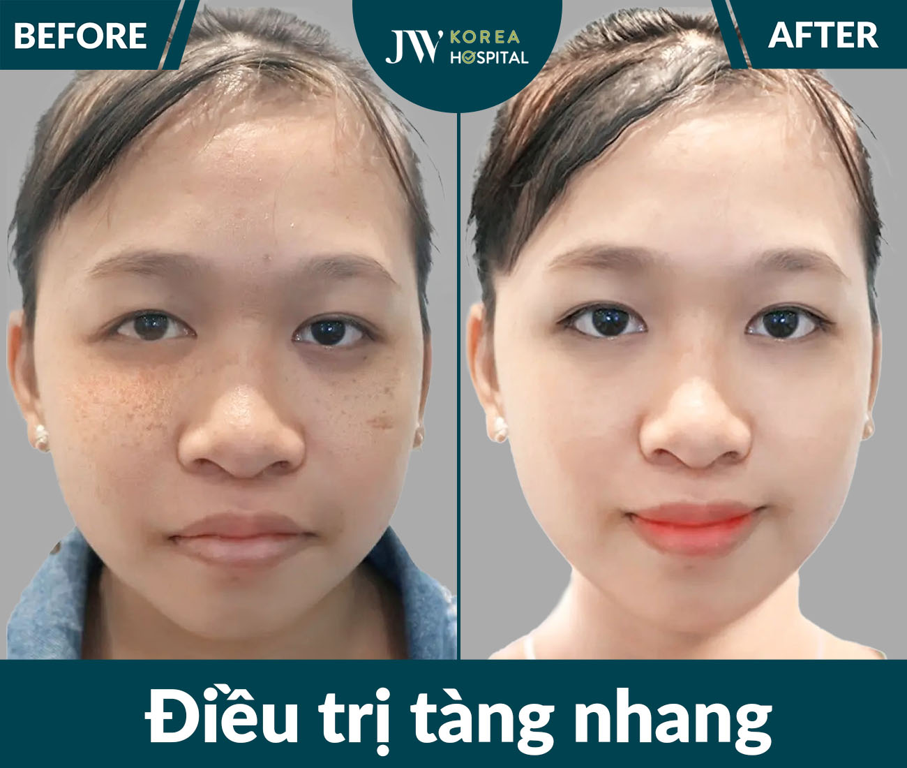Điều trị da