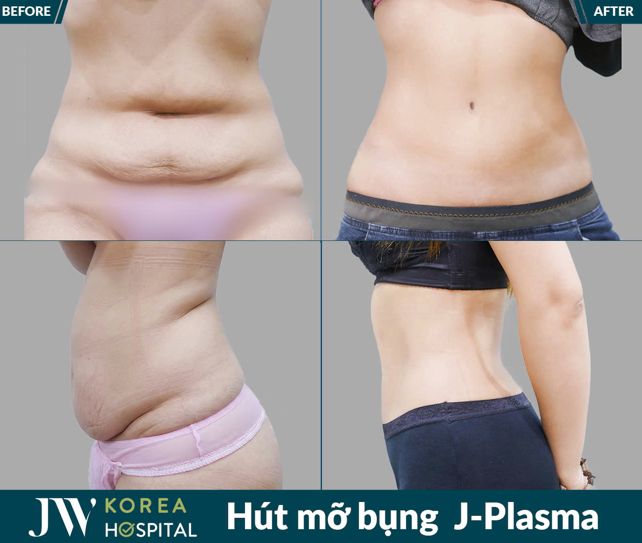 Dịch vụ giảm béo
