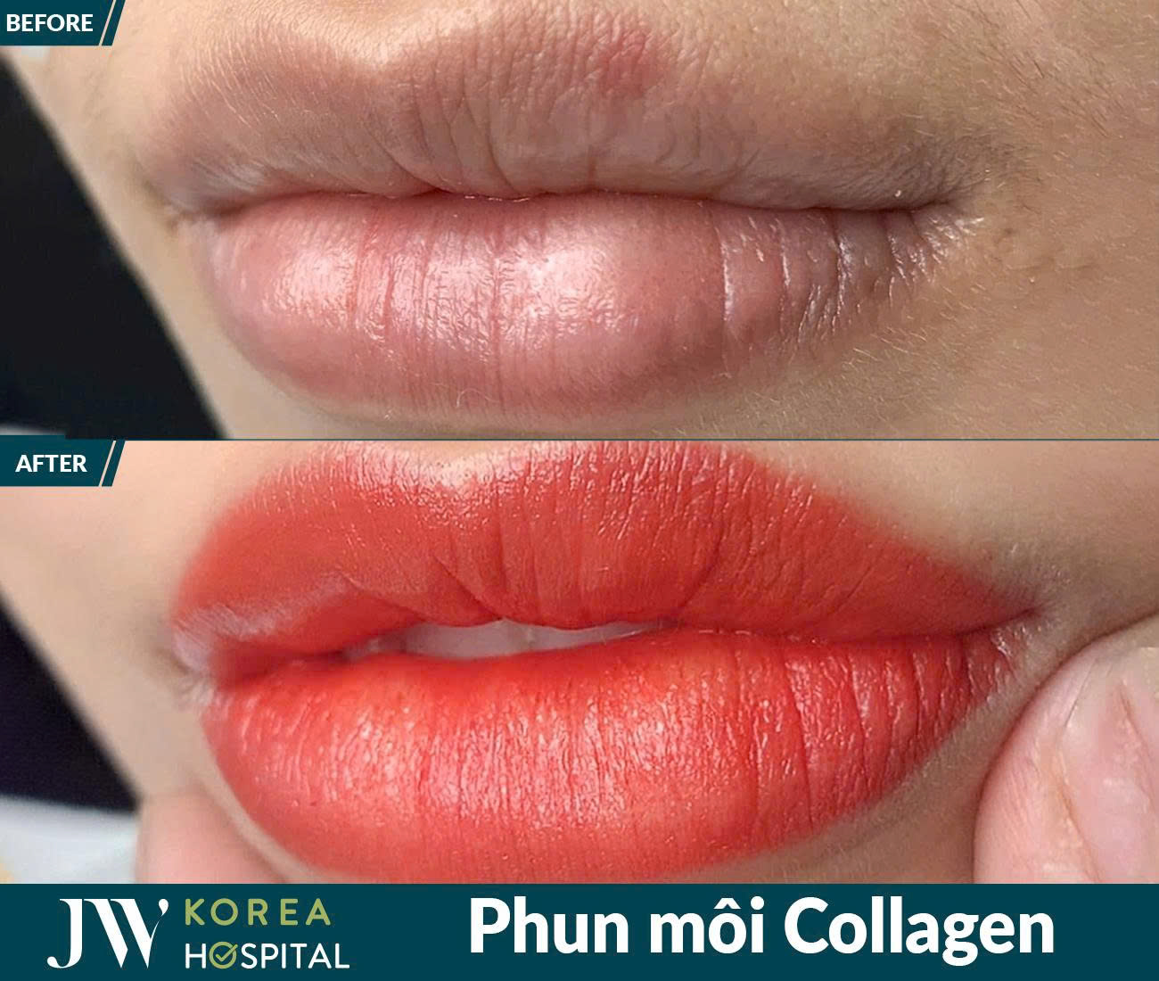 Phun xâm thẩm mỹ