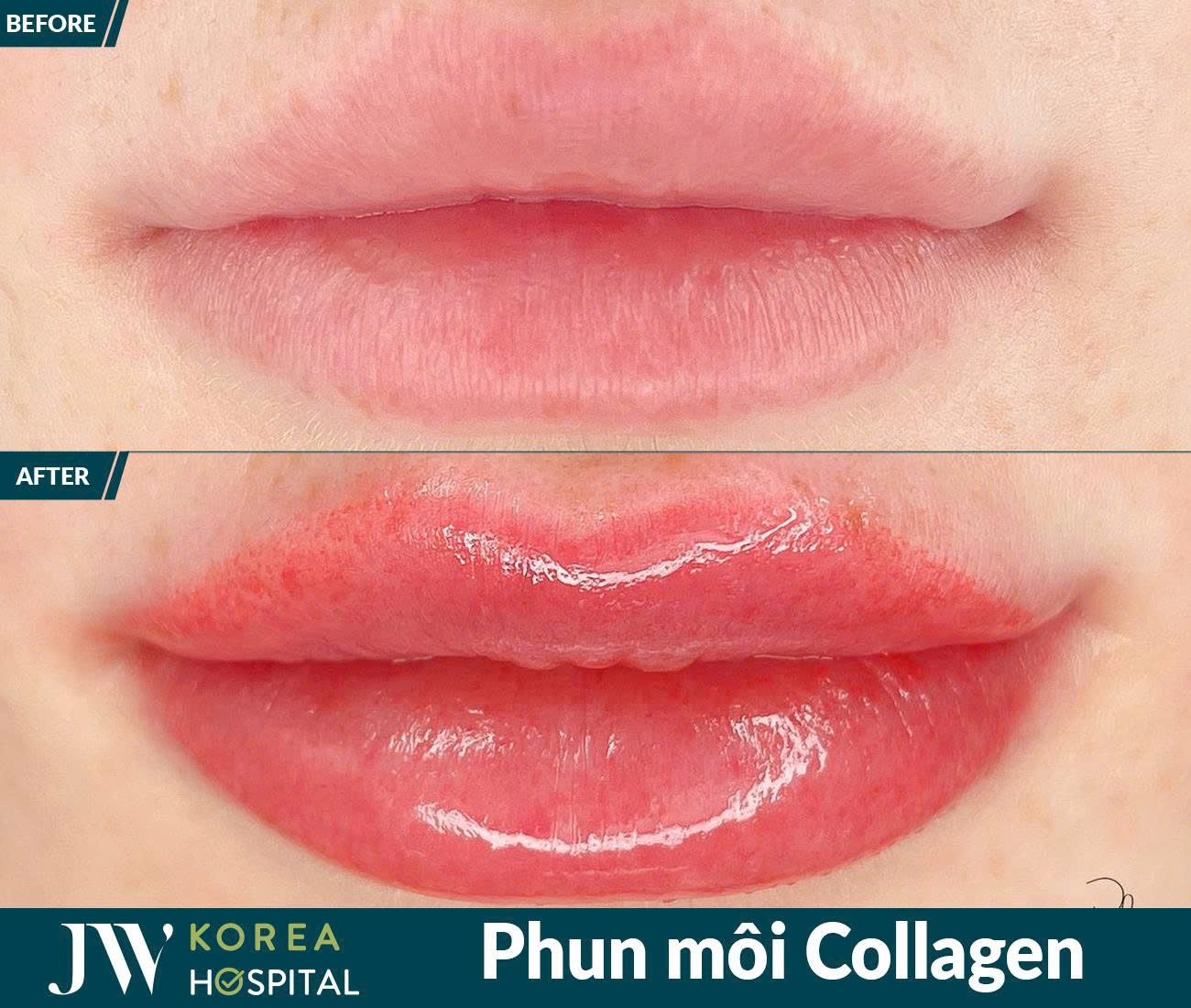 Phun xâm thẩm mỹ