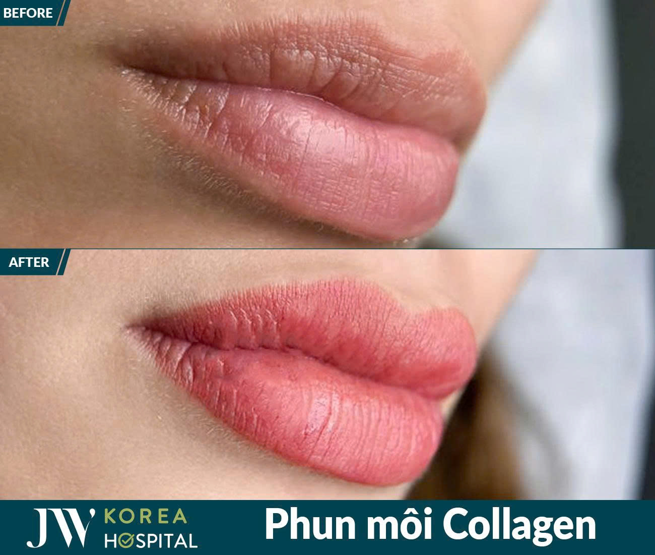 Phun xâm thẩm mỹ