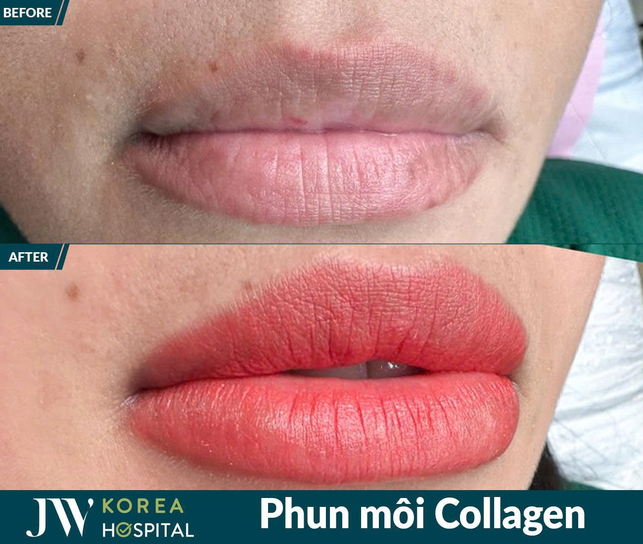 Phun xâm thẩm mỹ
