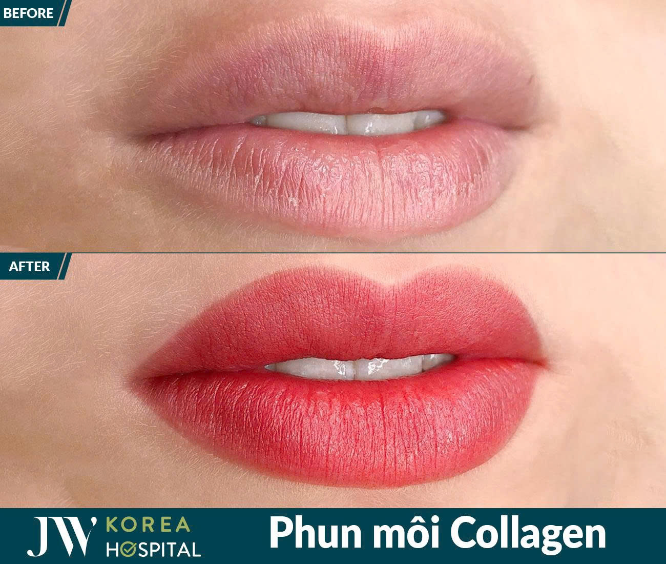 Phun xâm thẩm mỹ
