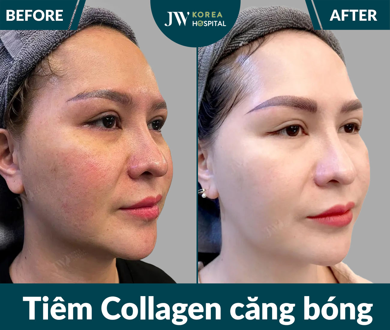 Điều trị da