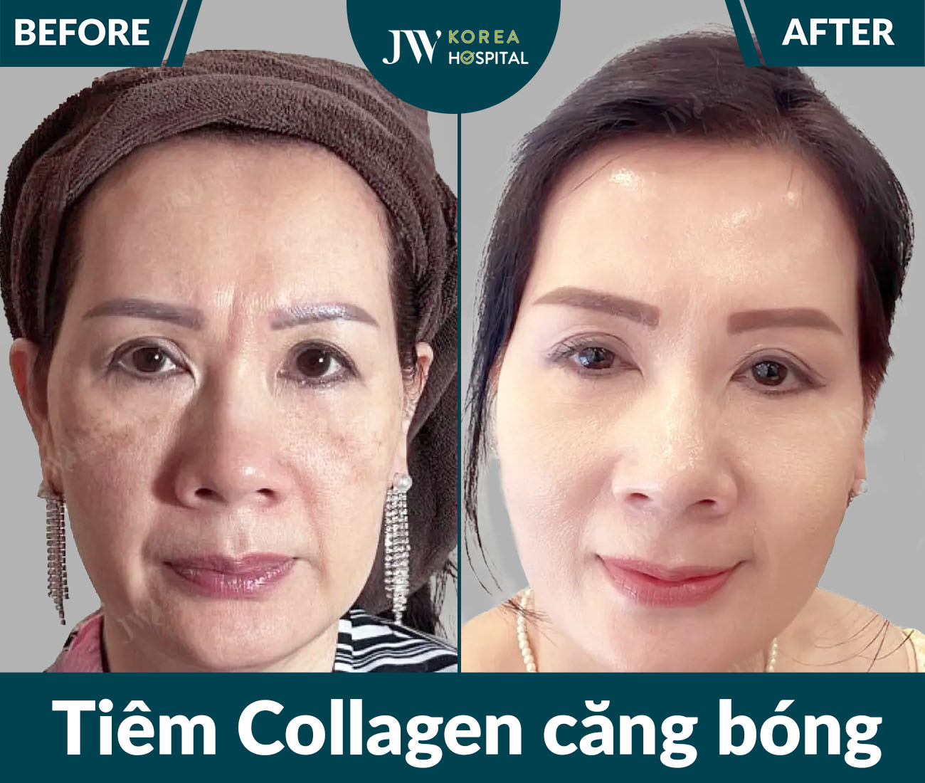 Điều trị da