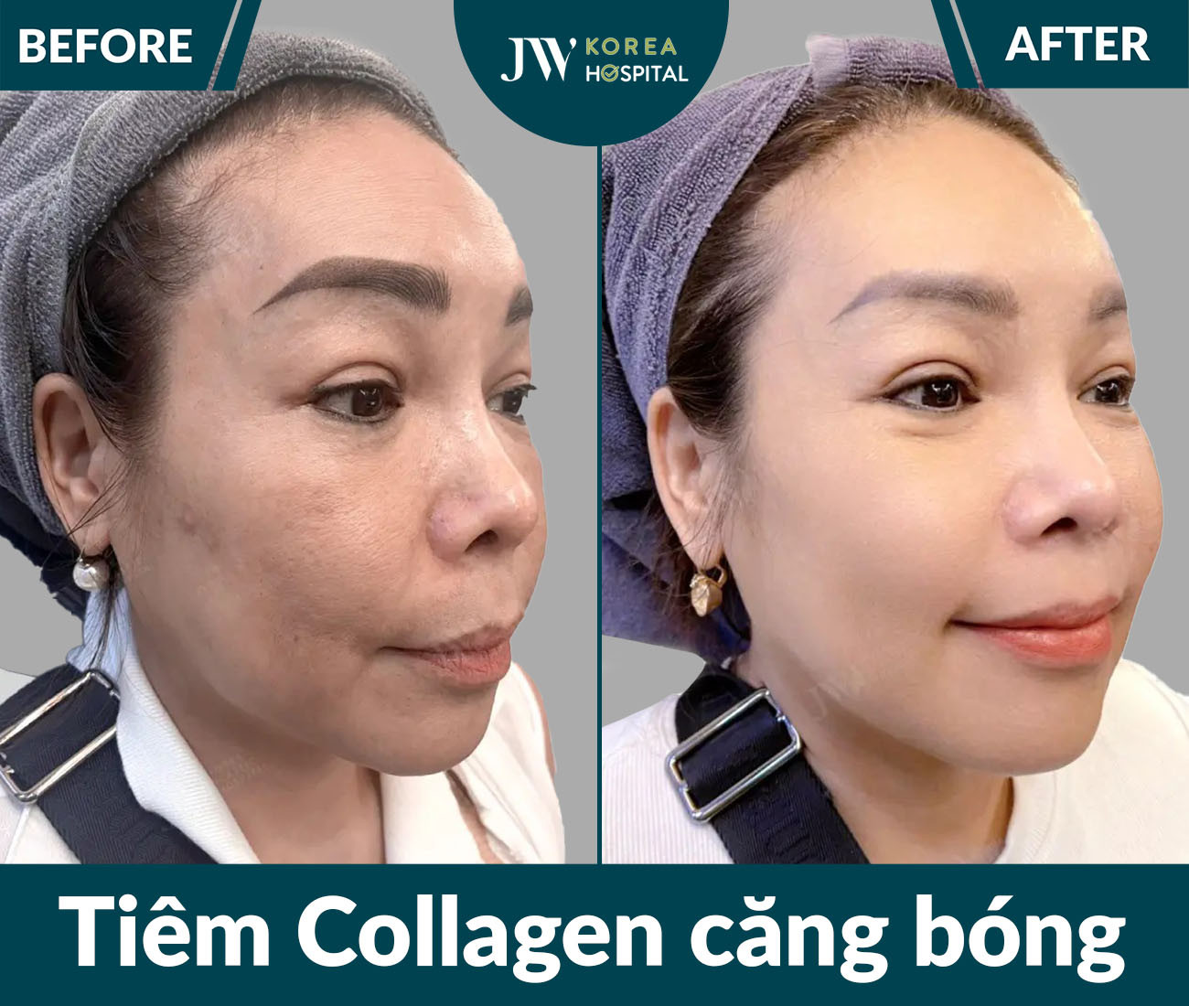 Điều trị da