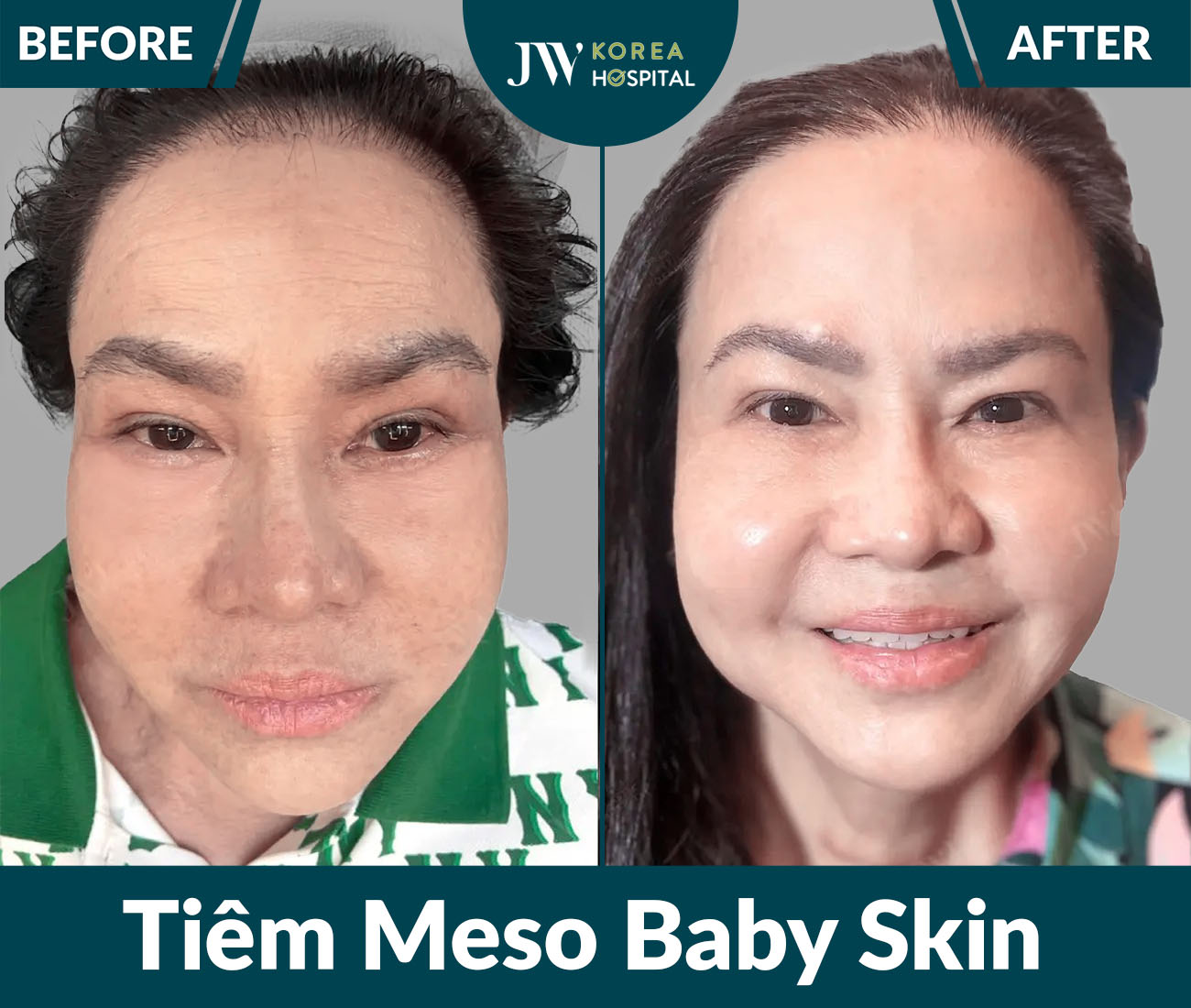 Điều trị da