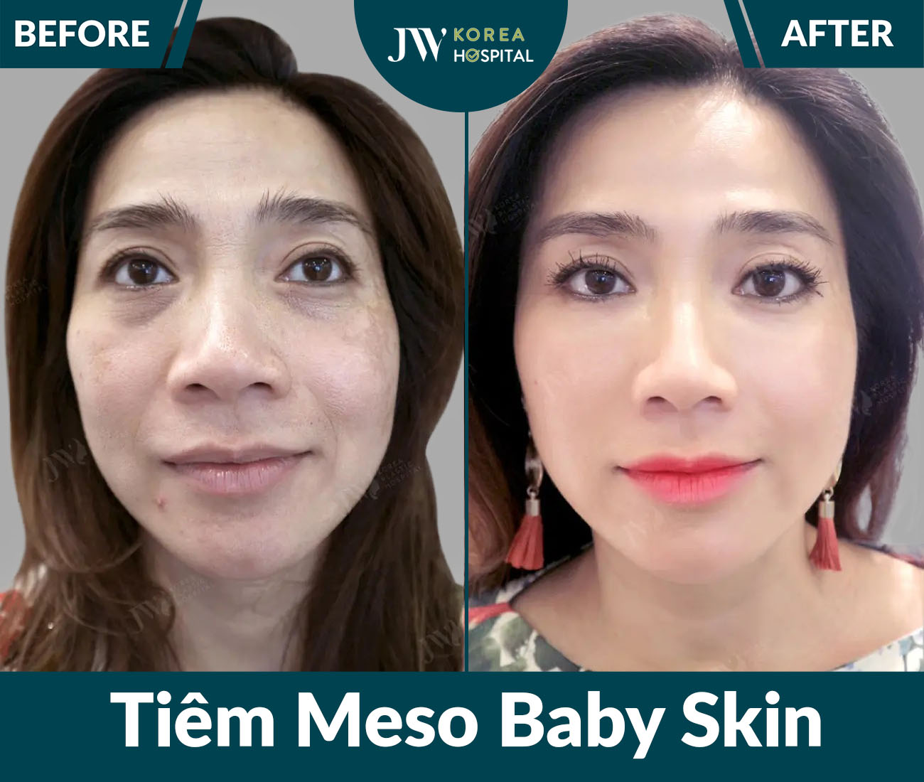 Điều trị da