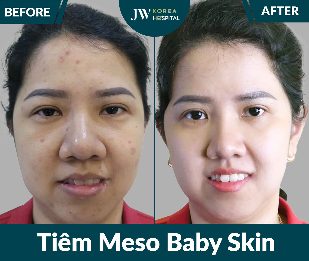 Điều trị da