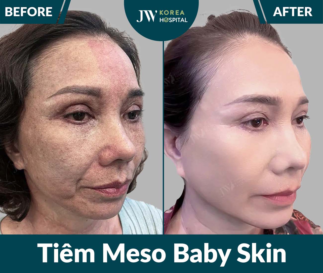 Điều trị da