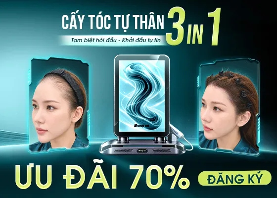Ưu đãi 70% cấy tóc tự thân 3 In 1