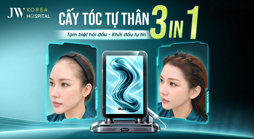 cấy tóc tự thân 3 in 1 tại JW
