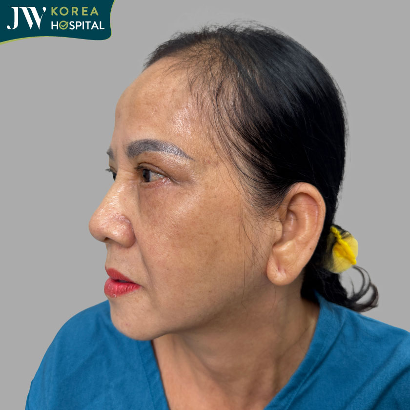 Quý cô quyết tìm JW để trẻ 20 tuổi
