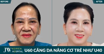 Quý bà Bình Dương được chồng dắt đến JW căng da mặt SMAS PRO trẻ 20 tuổi
