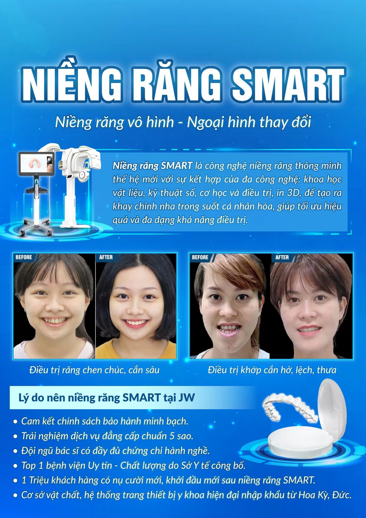 Niền Răng Niềng Răng SMART