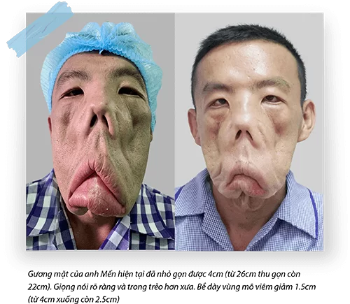 Tìm lại cuộc sống cho Anh Mến