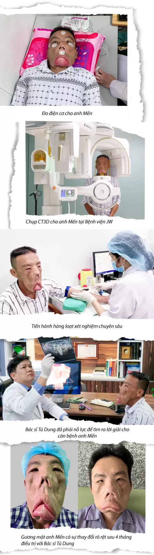 Tìm lại cuộc sống cho Anh Mến