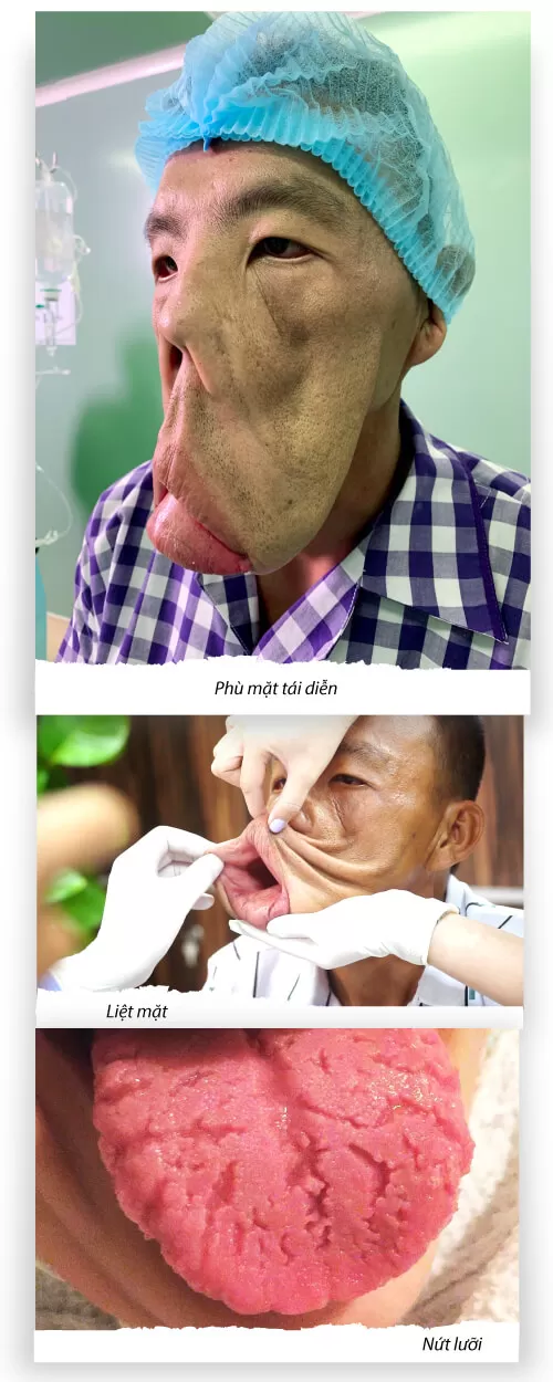 Tìm lại cuộc sống cho Anh Mến