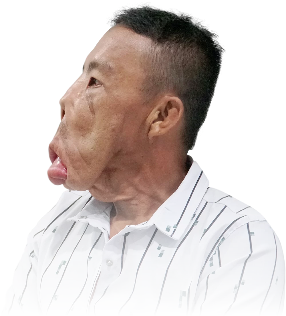 Tìm lại cuộc sống cho Anh Mến