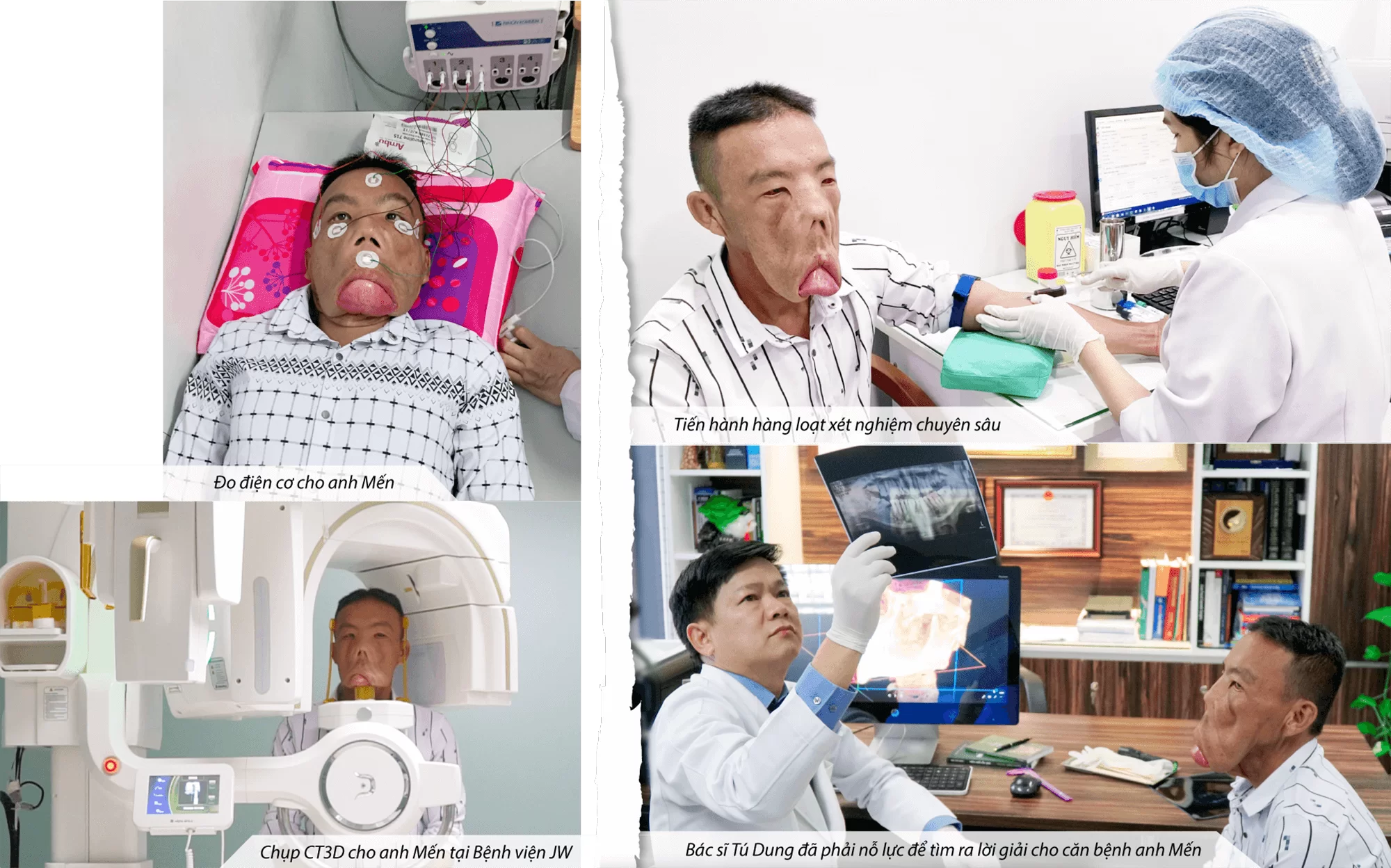 Tìm lại cuộc sống cho Anh Mến