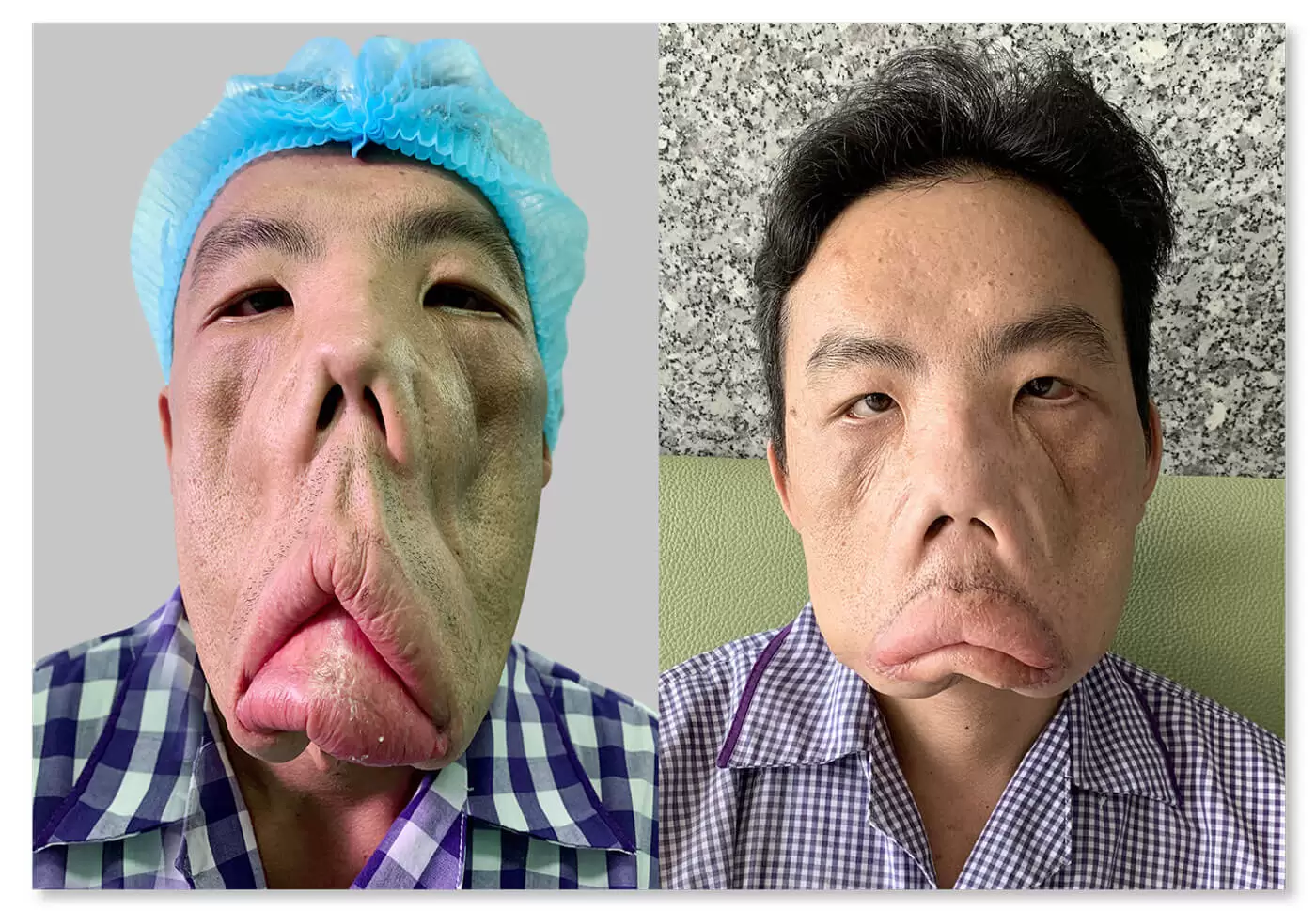 Tìm lại cuộc sống cho Anh Mến