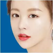 Bấm mí hàn quốc