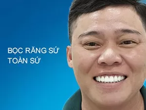 Bọc răng toàn sứ