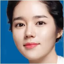 Cắt mắt hai mí