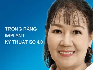 Trồng Răng implant kỹ thuật số 4.0