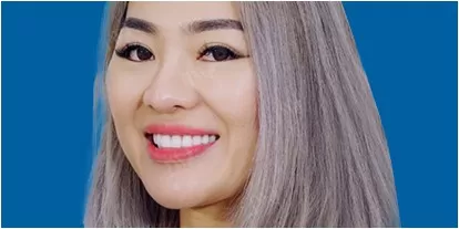 Dán sứ Veneer