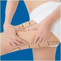 Hút mỡ bắt Tay/Đùi