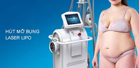 Hút mỡ bụng Laser Lipo