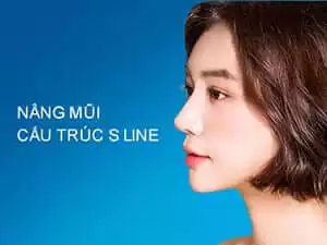 nâng mũi s line