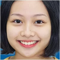 Nha khoa trẻ em