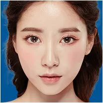 Thẩm mỹ mắt to