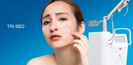 Trị Sẹo