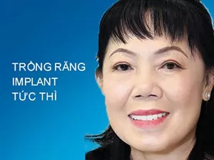Trồng răng Implant Tức Thì