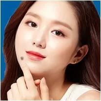 Xóa Nốt Ruồi