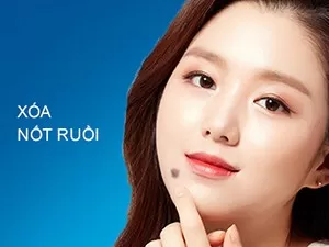 Xóa Nốt Ruồi