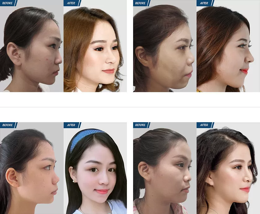 resize-anh-web