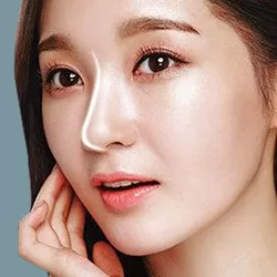 Nâng mũi S Line 3D + Chỉnh xương gồ