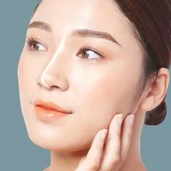 Nâng mũi S Line sụn tự thân + Sụn sườn