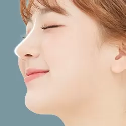 Nâng mũi Hàn Quốc