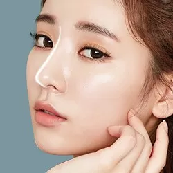 Nâng mũi bọc sụn <br> vành tai