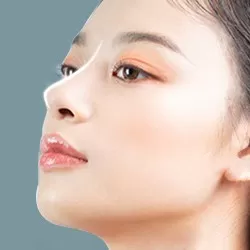 Nâng mũi bọc sụn vành tai + Sóng Megaderm
