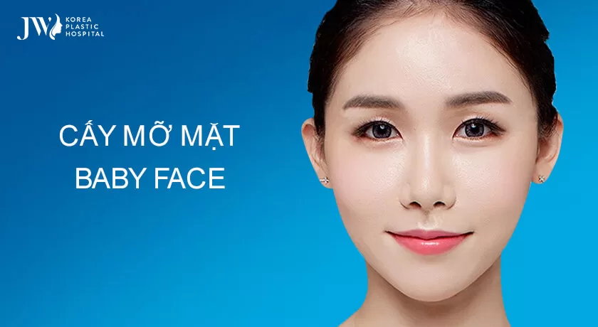 Cấy mỡ mặt Baby Face – mặt khắc khổ hoá trẻ trung đầy đặn