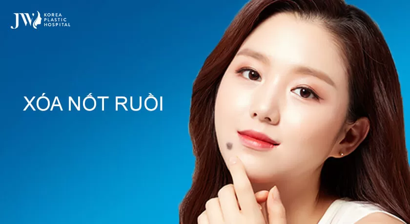 Banner-xoa not ruoi