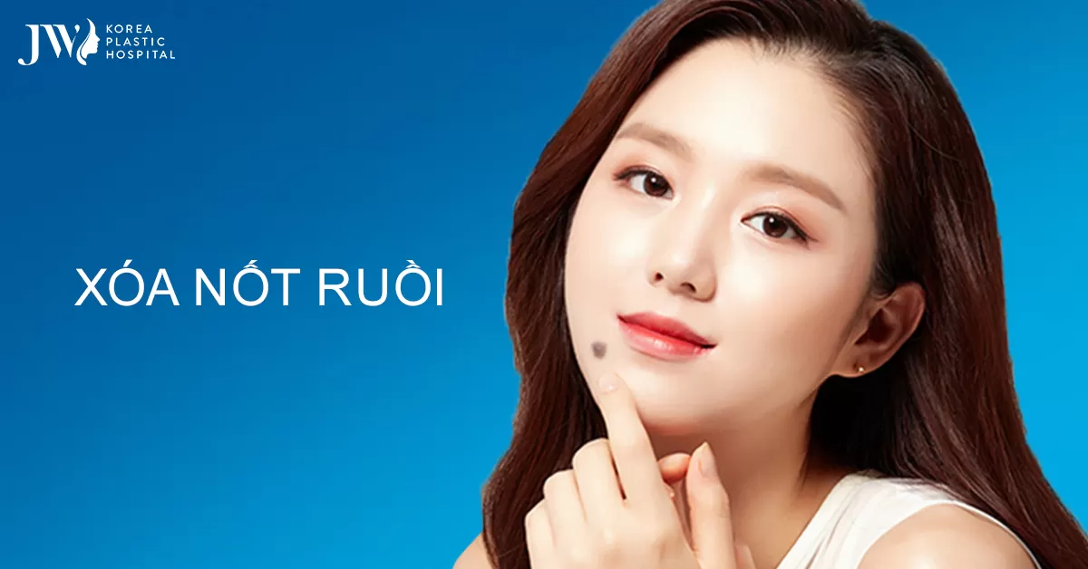 Xoá nốt ruồi – Đánh bay vận xấu trên mặt ngay tức thì